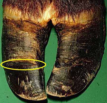 Horizontal Fissure Severity 2