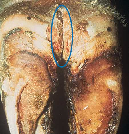 Interdigital Dermatitis Severity 1