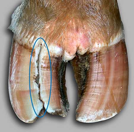 Vertical Fissure Severity 1