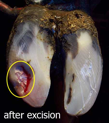 White Line Lesion Severity 2