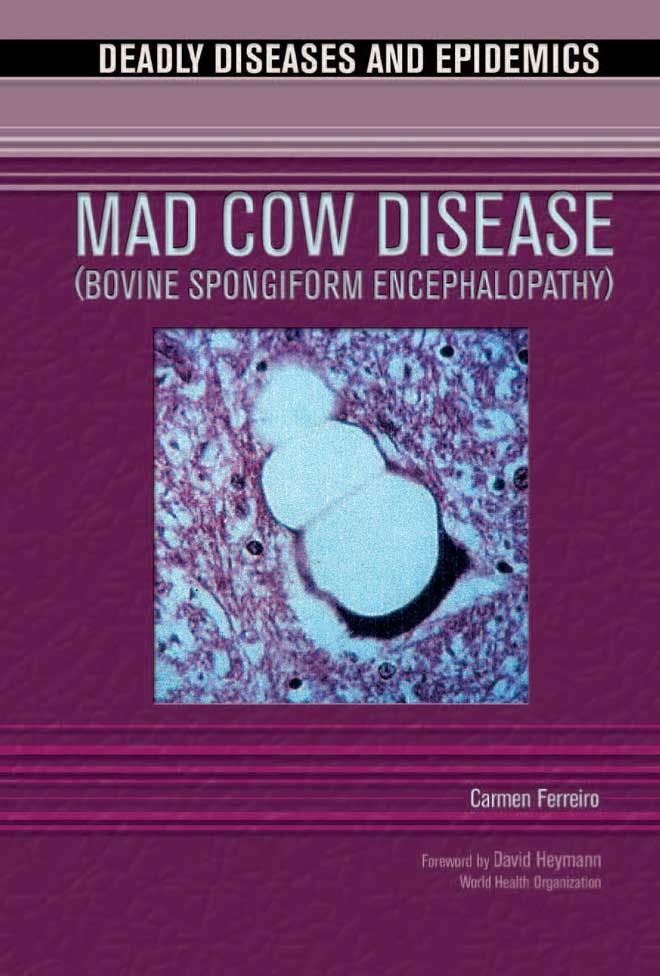 Mad cow disease